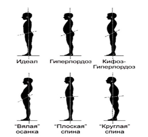 Мышечный корсет для позвоночника